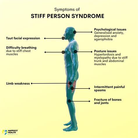 stiff body syndrome celine|what is stiff person syndrome.